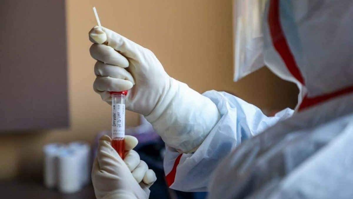В Одесі студентів із гуртожитків тестуватимуть на COVID-19 В Одесі студентів із гуртожитків тестуватимуть на COVID-19