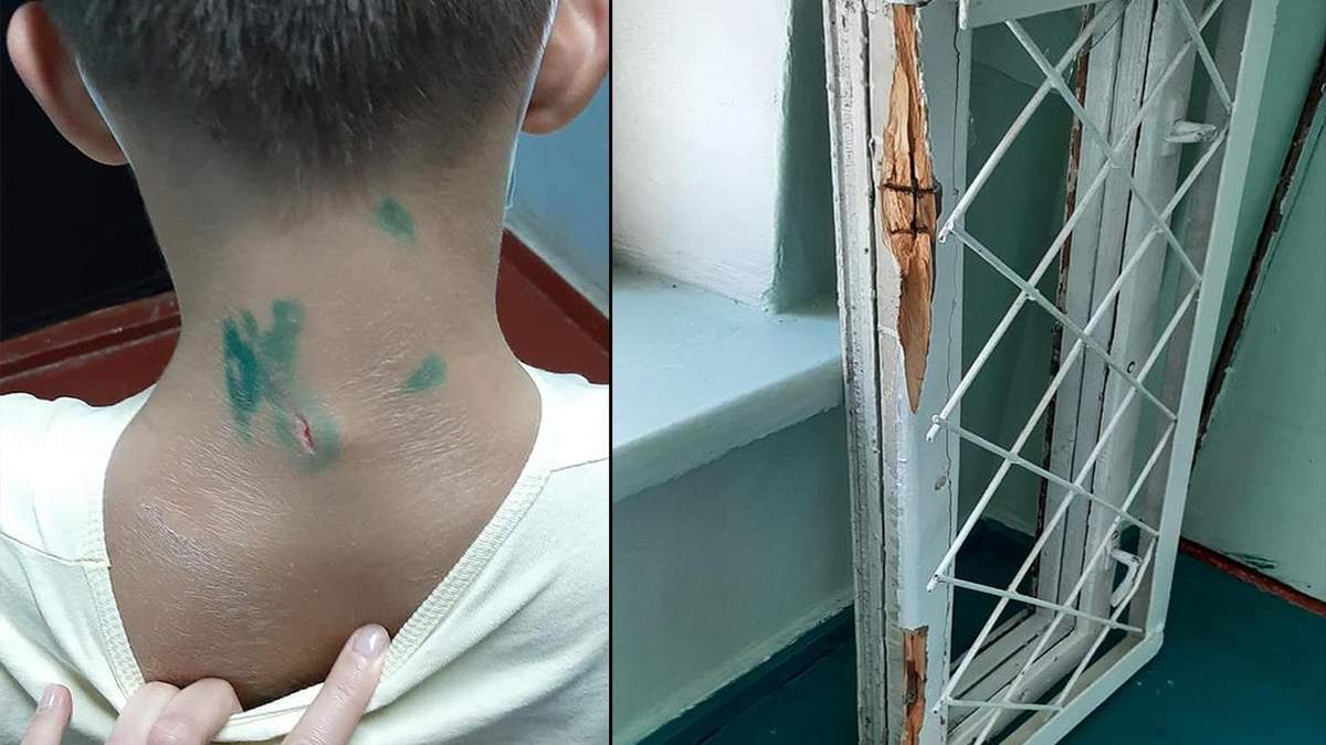 У Сумах під час уроку на учня впала віконна рама: моторошні фото У Сумах під час уроку на учня впала віконна рама: моторошні фото